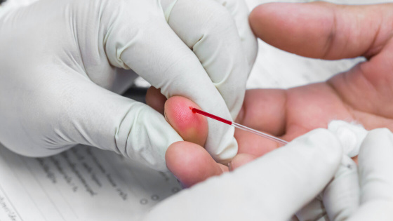 10 анализов, которые стоит сдать, если не удается похудеть